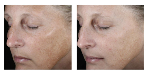 SkinBetter Science Even Intensive Skin Tone Correcting Serum 50mL - Image 4